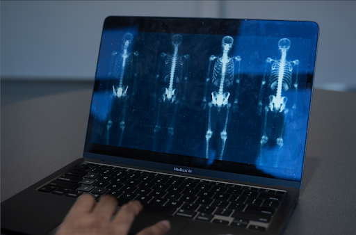 A image of a scanning of a human skeleton, which may allow doctors to thoroughly observe someones condition (This is not a real scan).